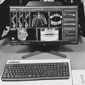 Chirurgie guidée et flux numérique